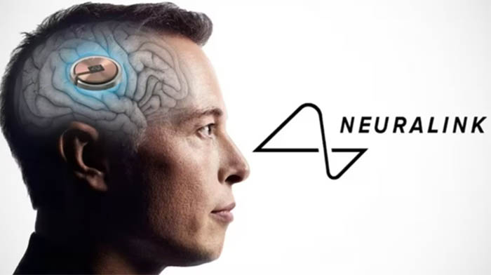 Neuralink